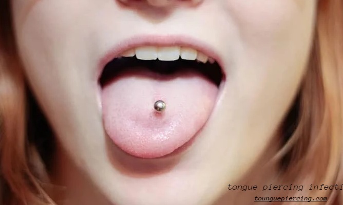 tongue piercing infection